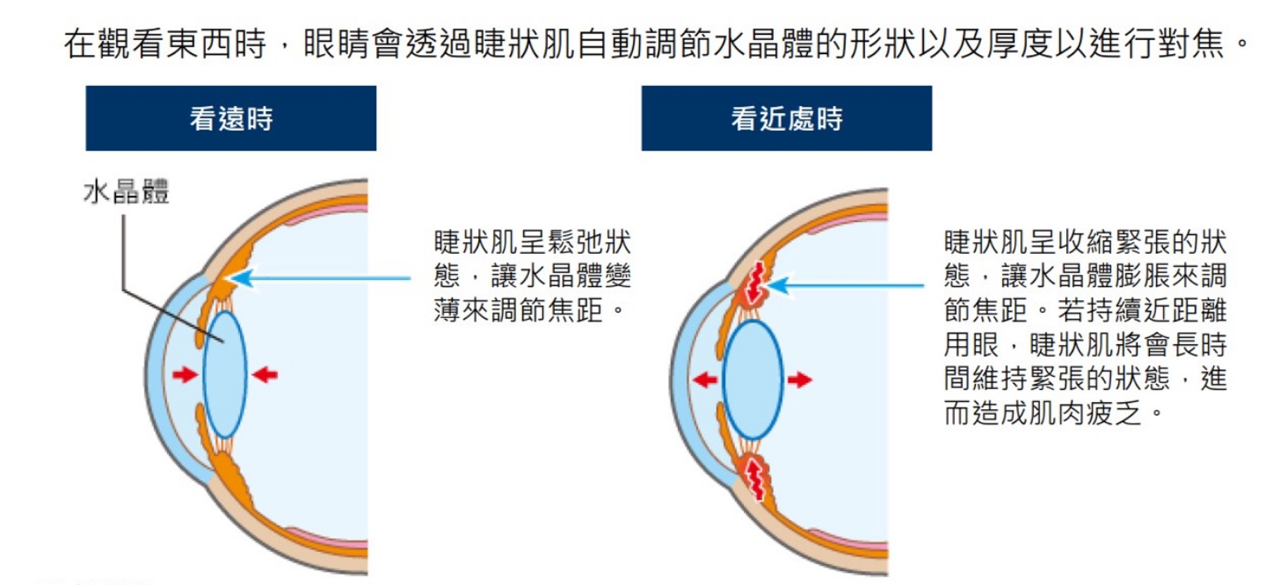 睫狀肌疲乏是造成眼睛疲勞的主因.jpg