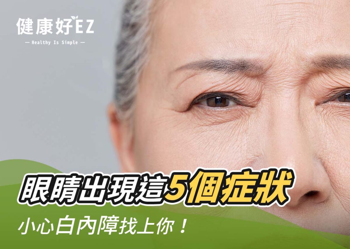 3招白內障預防密技